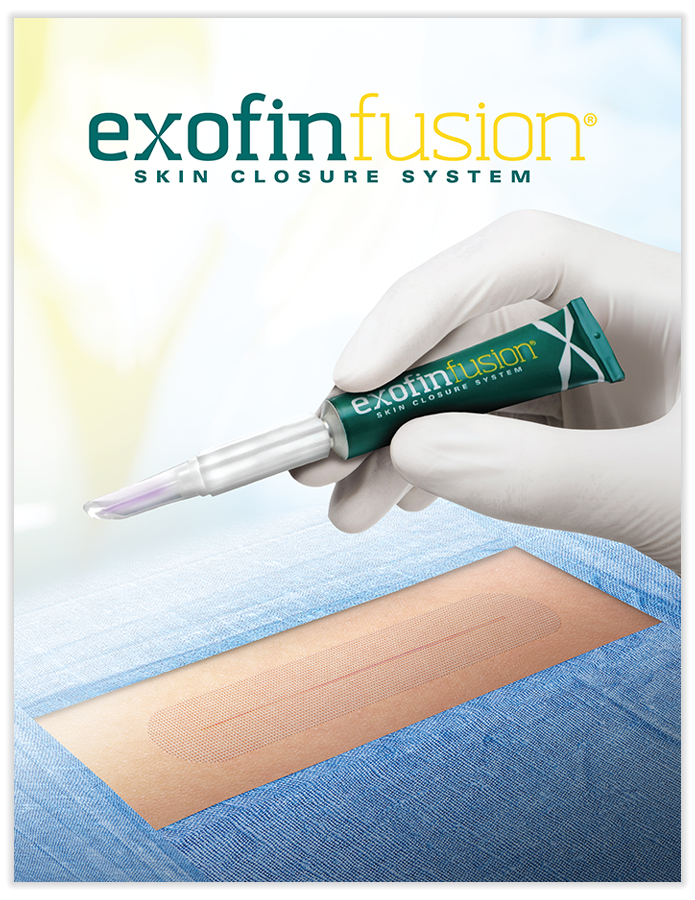 exofin Fusion Brochure
